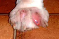 interdigitalcyst.webp