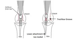 Patella.webp