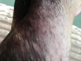 Skin condition