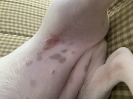 Rash??