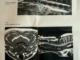 Help Cloe to walk again!