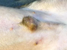 Yikes! Infected genital area?! *Pics of Pope*