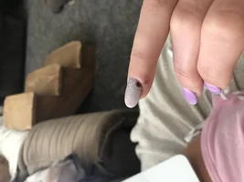 My frenchie attacked me!