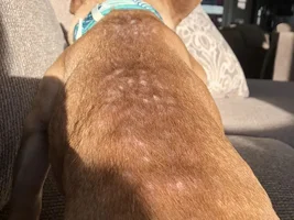 Hair loss
