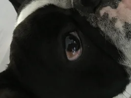 Whites of eyes going brown?