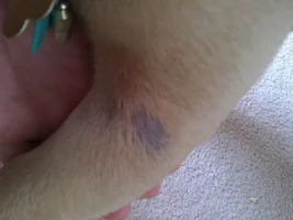 Bald patch on leg..... (pic attached)