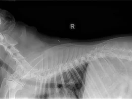 Back Injury- need advice/ knowledge