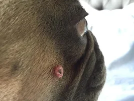 Red bump or wart on side of cheek