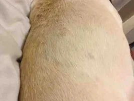 Tiny Bumps on Skin