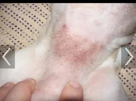 Skin rash