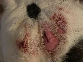 RIngworm or Staph?