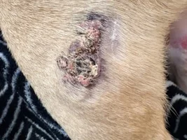 Bacteria Skin Infection
