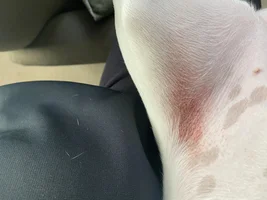 Rash??