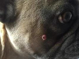 Red bump or wart on side of cheek