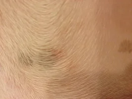 Bumps and rashes!