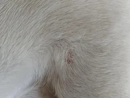 Skin problem small bumps, yeast? allergy?