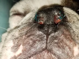 Popped stitch 3 days after nares surgery