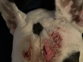 RIngworm or Staph?