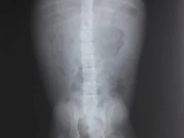 Nero's hip