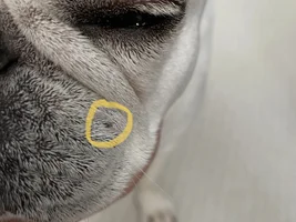 Hair follicle growth on face