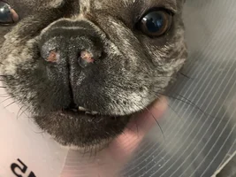 Nares surgery