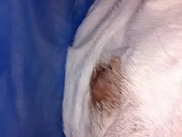 Hives