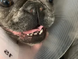 Nares surgery
