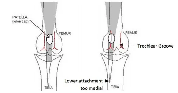 Patella.jpg